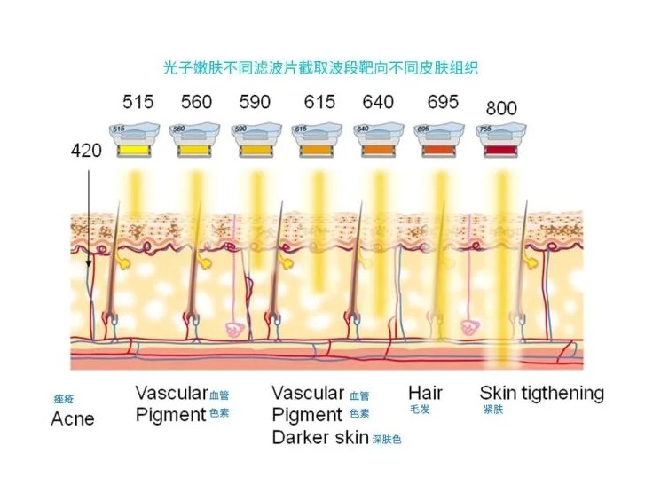 五大光子嫩膚技術(shù)（IPL、DPL、OPT、APT、BBL）及濾光片區(qū)別